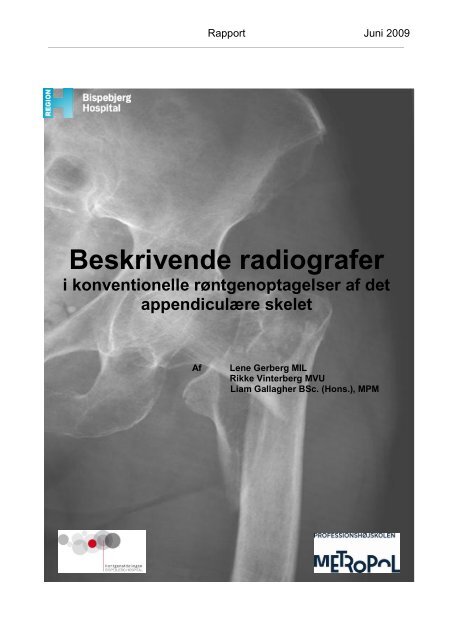 Beskrivende radiografer i konventionelle røntgenoptagelser af det ...