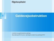 Galdevejsobstruktion