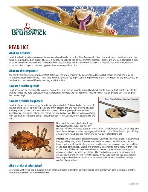 (Head lice) (PDF) - Government of New Brunswick