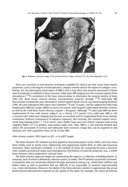 Quantifying the material and structural determinants of bone strength