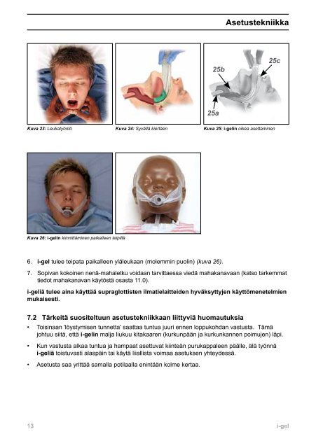 Käyttäjän opas - i-gel - Intersurgical