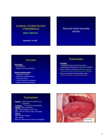 Red and mixed red-white lesions