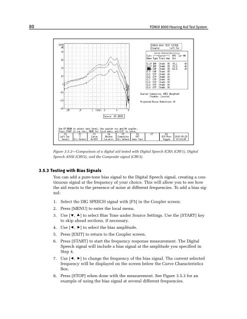 FONIX® 8000 - Frye Electronics