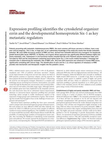 Expression profiling identifies the cytoskeletal organizer ezrin and ...