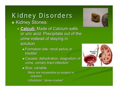 The Urinary System Ch. 22 HBHD