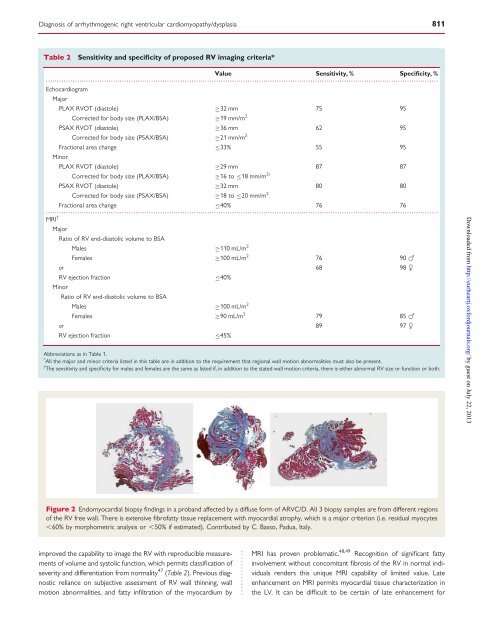 Diagnosis of arrhythmogenic right ventricular cardiomyopathy ...