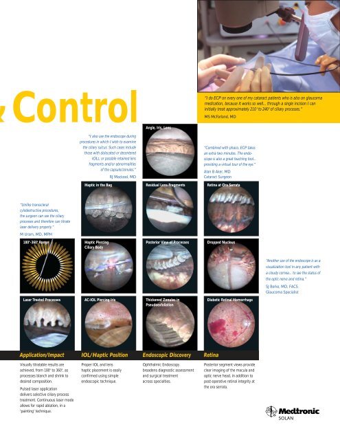 Endoscopic Photocoagulation - Meridian