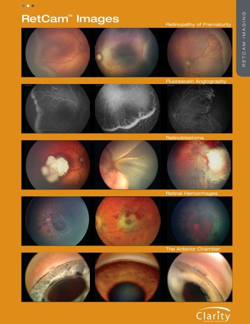 Lenses & Images Data Sheet - Clarity Medical Systems