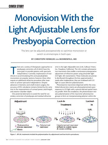 Monovision With the Light Adjustable Lens for Presbyopia ... - Iogen