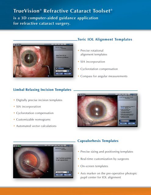 Refractive Cataract Toolset - Iogen