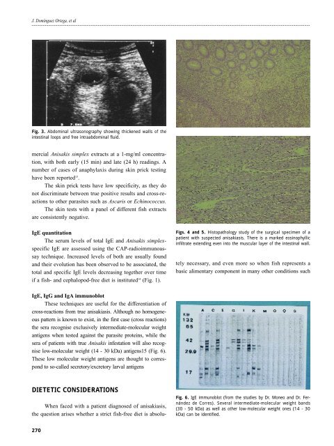 Guidelines in pathology induced by Anisakis Original Article