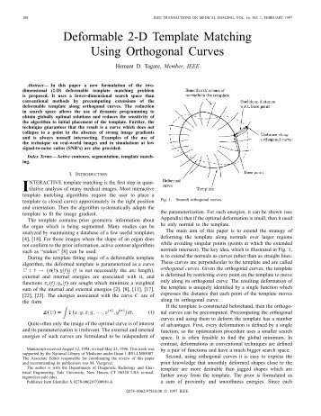 Deformable 2-D Template Matching Using Orthogonal Curves ...