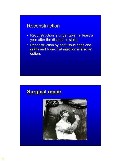 Lecture Craniofacial Limoudei Hemsech