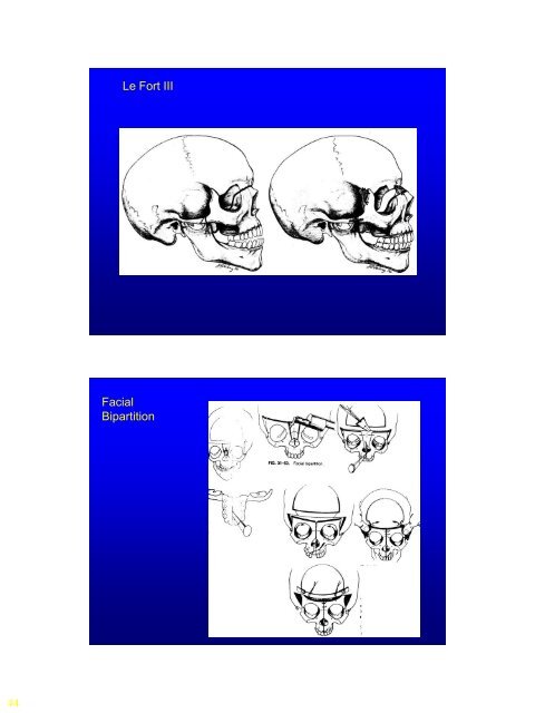 Lecture Craniofacial Limoudei Hemsech