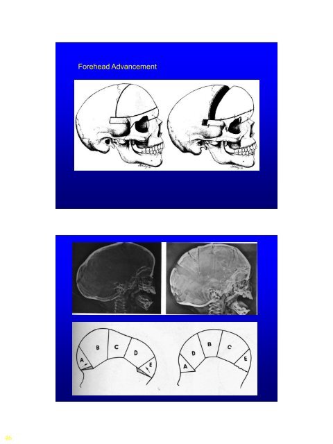 Lecture Craniofacial Limoudei Hemsech