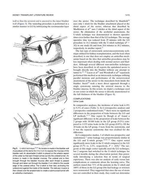 Kidney Transplant Ureteroneocystostomy Techniques and ...