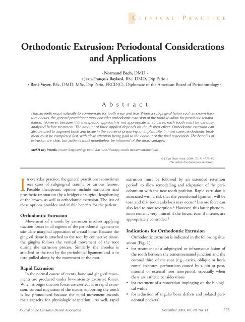 Orthodontic Extrusion: Periodontal Considerations and Applications