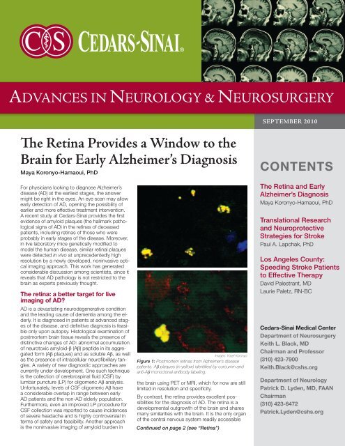 The Retina Provides a Window to the Brain for Early ... - Cedars-Sinai