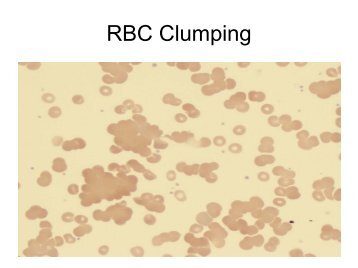 RBC Clumping