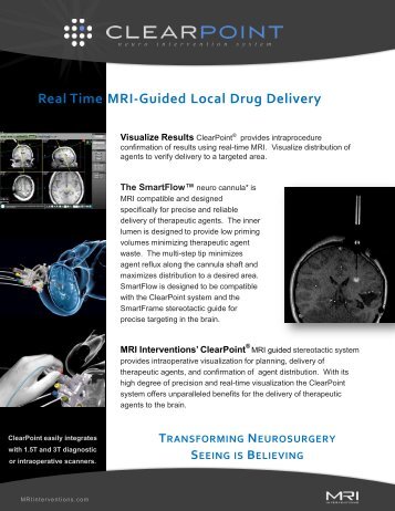 Real Time MRI-Guided Local Drug Delivery