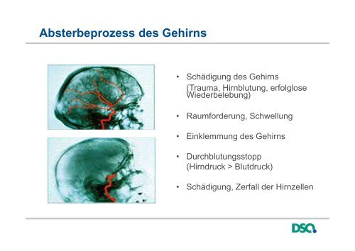 Präsentation Organspende