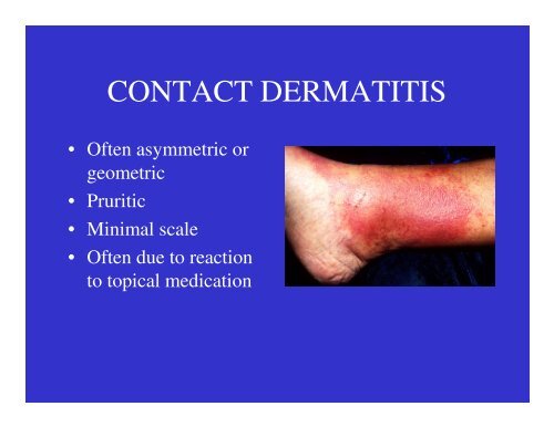 Dermatology Rash Lecture