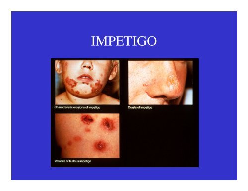 Dermatology Rash Lecture