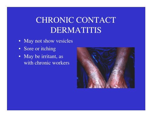 Dermatology Rash Lecture