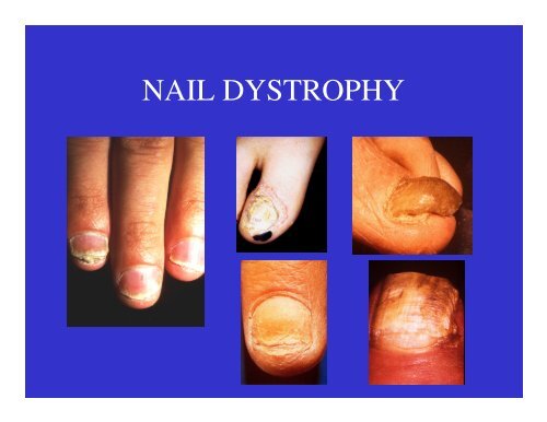 Dermatology Rash Lecture