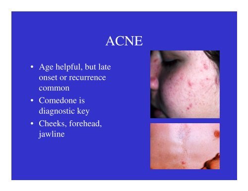Dermatology Rash Lecture