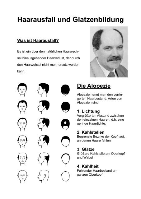 Haarausfall und Glatzenbildung