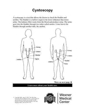 Cystoscopy - Patient Education Home