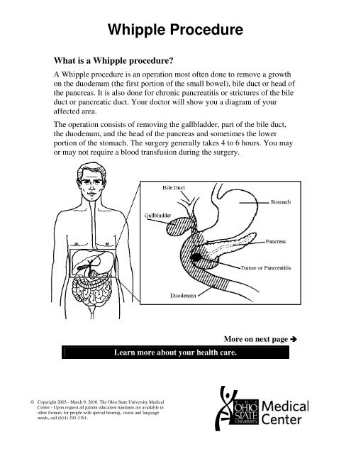 Whipple Procedure Patient Education Home