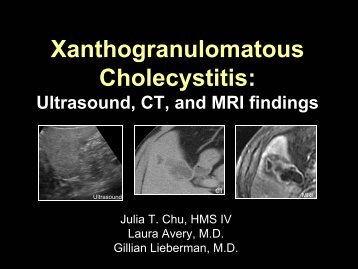 Xanthogranulomatous cholecystitis vs Gallbladder carcinoma