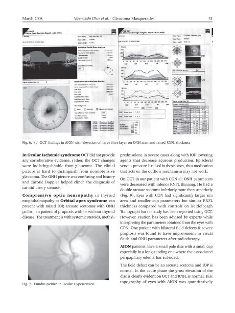 Glaucoma Masqueraders – Our Clinical Experience – Has ... - KSOS