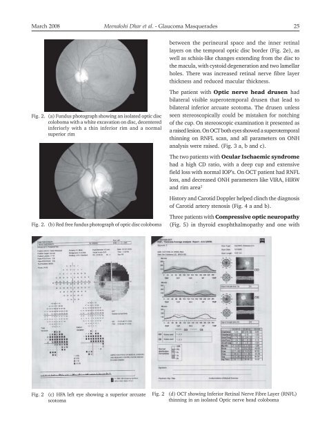 Glaucoma Masqueraders – Our Clinical Experience – Has ... - KSOS