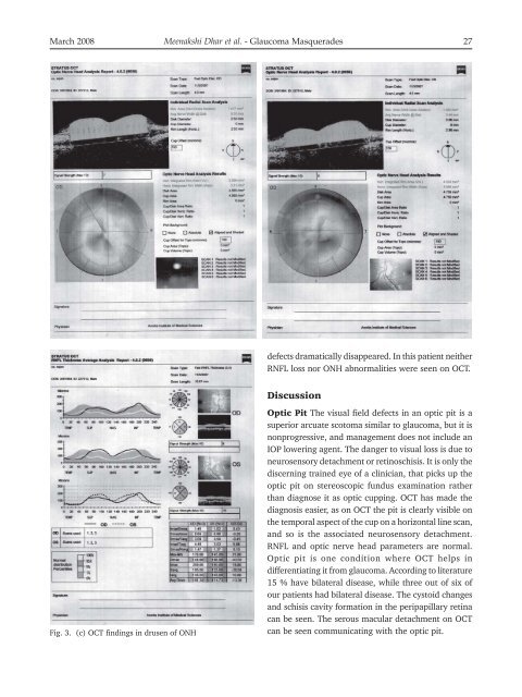 Glaucoma Masqueraders – Our Clinical Experience – Has ... - KSOS