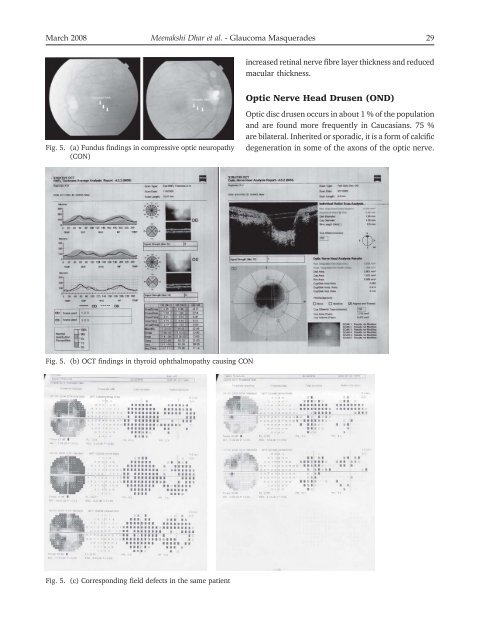 Glaucoma Masqueraders – Our Clinical Experience – Has ... - KSOS