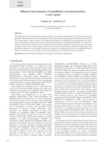 bilateral fusion of mandibular second molars Fusion is a developmental anomaly characterized by the union of two adjacent teeth in this article we report a rare case of bilateral fusion of permanent mandibular. bilateral fusion of mandibular second molars Fusion is a developmental anomaly characterized by the union of two adjacent teeth in this article we report a rare case of bilateral fusion of permanent mandibular.
