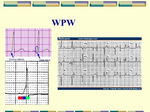 Wrist and Hand Conditions