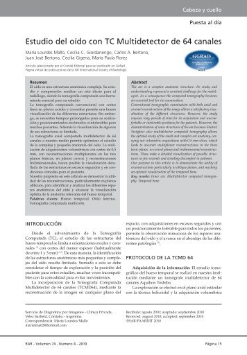 Estudio del oído con TC Multidetector de 64 canales - International ...