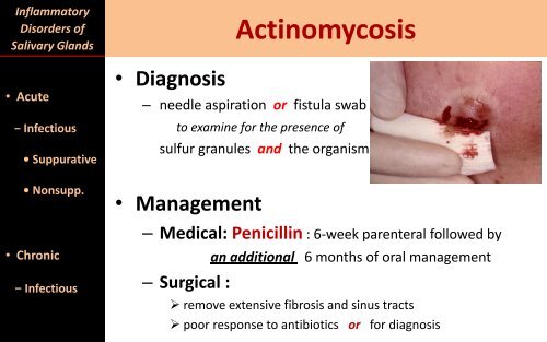 Inflammatory Disorders of Salivary Glands