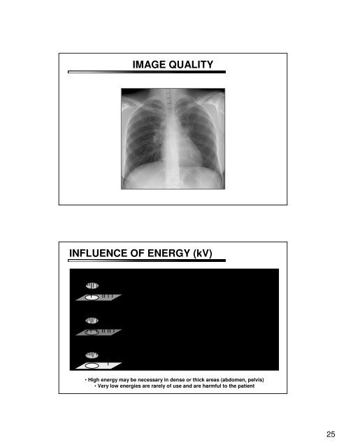 Screen Film Radiology