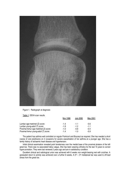 An unusual stress fracture of the proximal phalanx of the great toe: A ...