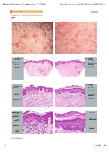 Differential Diagnosis in Dermatopathology, Third Edition