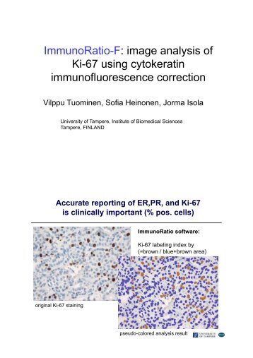 ImmunoRatio-F: image analysis of Ki-67 using cytokeratin ...