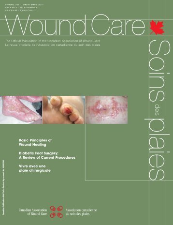 Basic Principles of Wound Healing Diabetic Foot Surgery: A Review ...