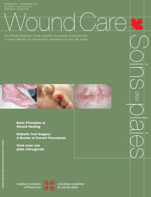 Basic Principles of Wound Healing Diabetic Foot Surgery: A Review ...