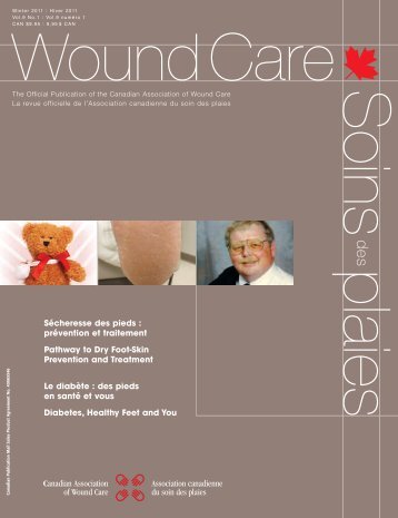 Sécheresse des pieds - Canadian Association of Wound Care