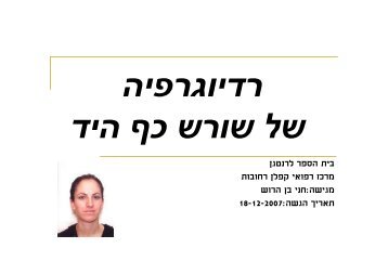 צילומי שורש כף היד